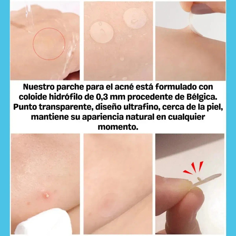 🔥 Parches dia/ noche quita espinillas tapa acné set 3
