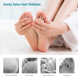FVION Callus Rasp Foot File, Double-Sided Coarse Stainless Steel, Laser Foot Rasp Callus Remover for Pedicure and Foot Care with Ergonomic Handle