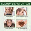 Pure Natural Rosemary Essential Oils - 2 pack, Hair Growth