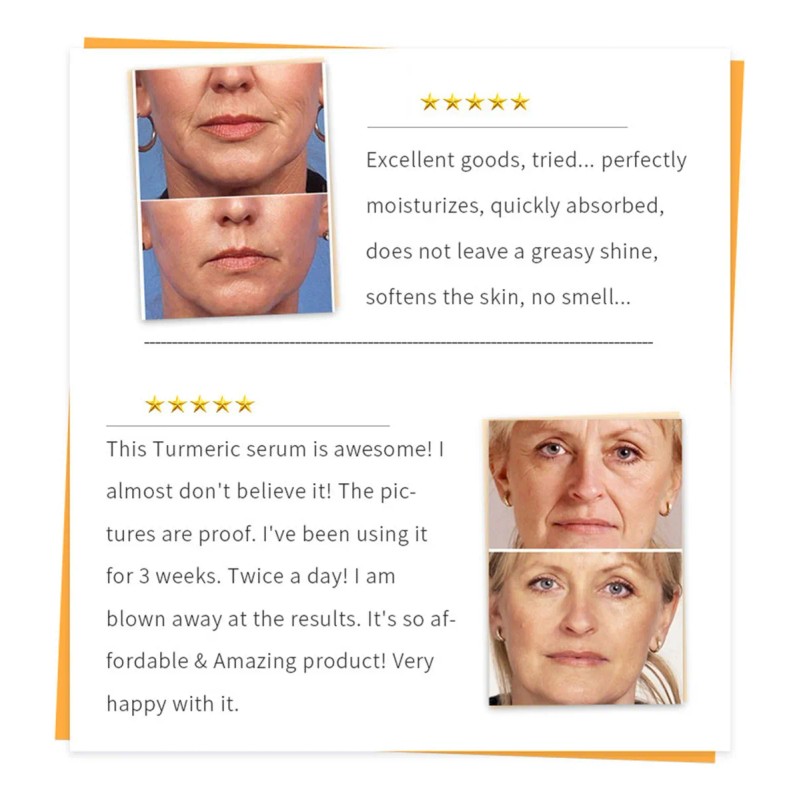 Suero Corrector De Manchas Oscuras De Cúrcuma B For &aq