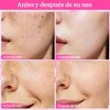 7.0 + TXA 4.0.CREAM Crema de manchas faciales