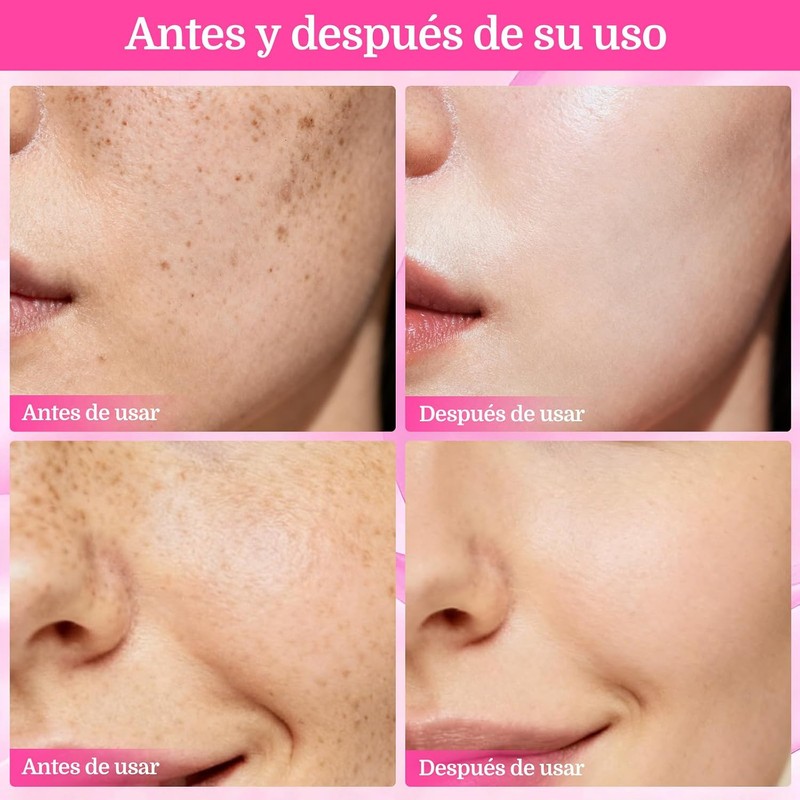 7.0 + TXA 4.0.CREAM Crema de manchas faciales