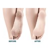 Electric Foot Callus Remover Automatic Safety Lock Multi Functional Rechargeable