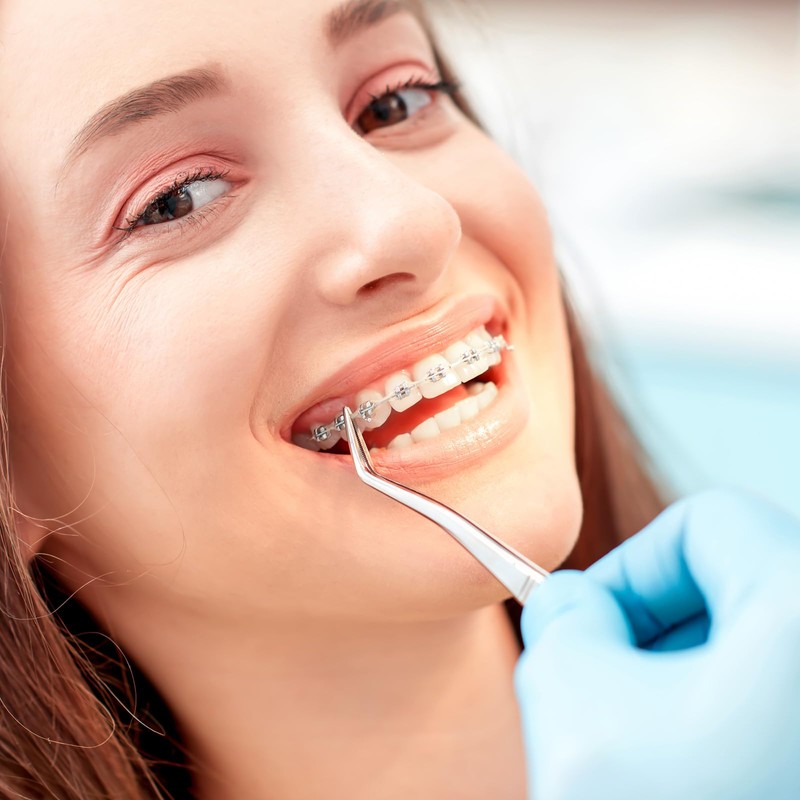 JMU Orthodontic Elastic Power Chain for Braces, 15Feet/ Roll, Long,