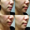 로터스 퓨어 아우라 필링 젤(1+1) Lotus Pure Aura Peeling Gel