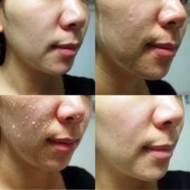 로터스 퓨어 아우라 필링 젤(1+1) Lotus Pure Aura Peeling Gel (1+1)