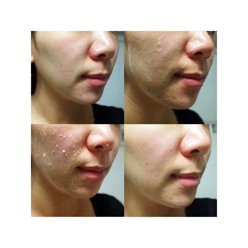로터스 퓨어 아우라 필링 젤(1+1) Lotus Pure Aura Peeling Gel