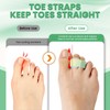 Pnrskter Hammer Toe Straightener for Women & Men - 6