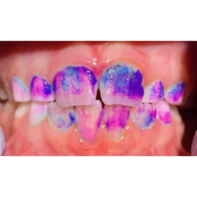 Gc Tri Plaque Id Gel Revelador Placa 36 Ml Hecho