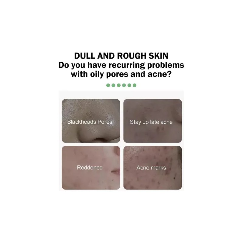 Mopoyat Suero Facial Con Ácido Salicílico 30ml