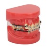 Professional Dental Demonstration Orthodontic Model with Metal Wires and Bracket
