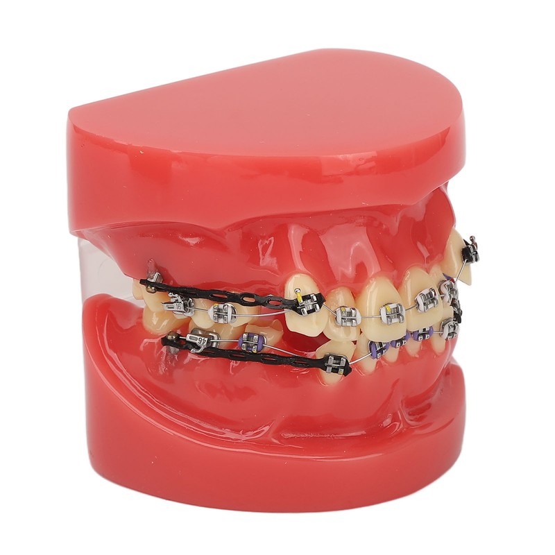 Professional Dental Demonstration Orthodontic Model with Metal Wires and Bracket