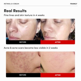 FRANKLY [ FRANKLY ] Retinol 0.3% Cream 20ml / 0.7 fl oz