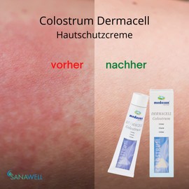 Colostrum Dermacell | Skin Protection Cream | Scar Care | for Dry and Irritated Skin | Eczema | Psoriasis | Skin Irritations | for Soft Skin | Set of 2