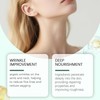 Crepey Skin Repair Tratamiento Crema (1PCS)