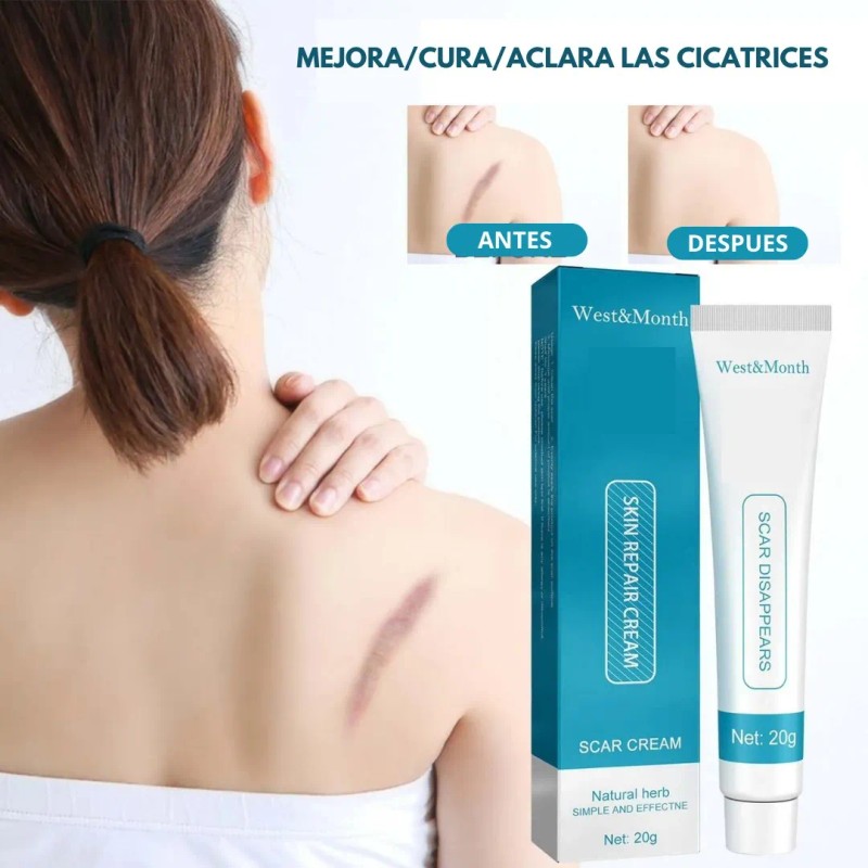 Crema Despigmentatnte Manchas Cicatrices Paño