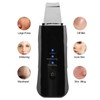 Face Skin Scrubber USB Rechargeable Peeling Machine Ultrasonic Exfoliating SkinCare(Black