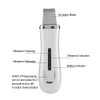 Ultrasonic Face Skin Scrubber Blackhead Removal Ion Cleaner Facial Cleanser
