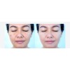Venzen Exfoliante Suave Carbon Bamboo Venze Acido Hialuronico