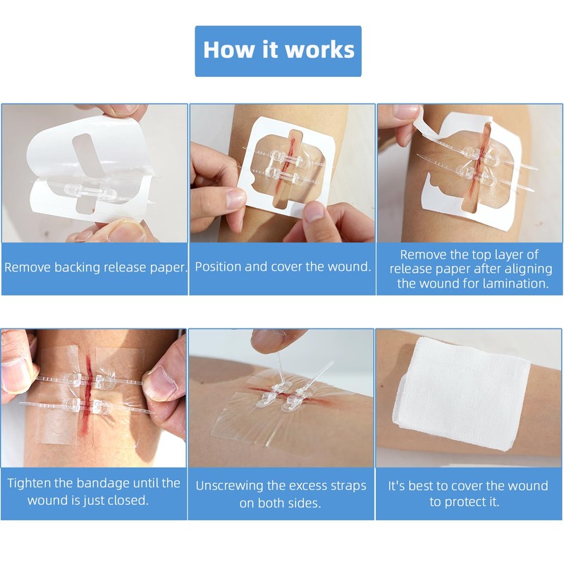 Emergency Wound Closure Devices, Zipper Wound Closure Strips, Laceration Closure