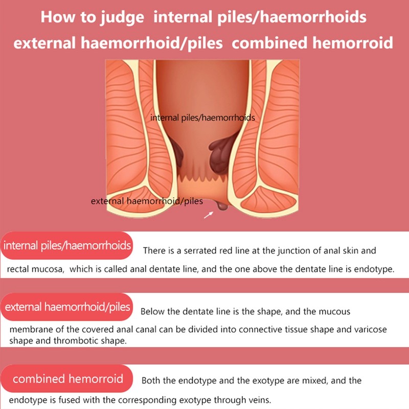 Deejuns Haemorrhoid Cream 20g - Haemorrhoid Treatment and Prevention, Relieves