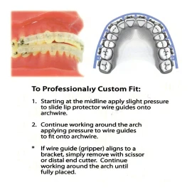 Orthomechanics Nuestros Aparatos Dentales Más Vendidos, Escudo Protector (1