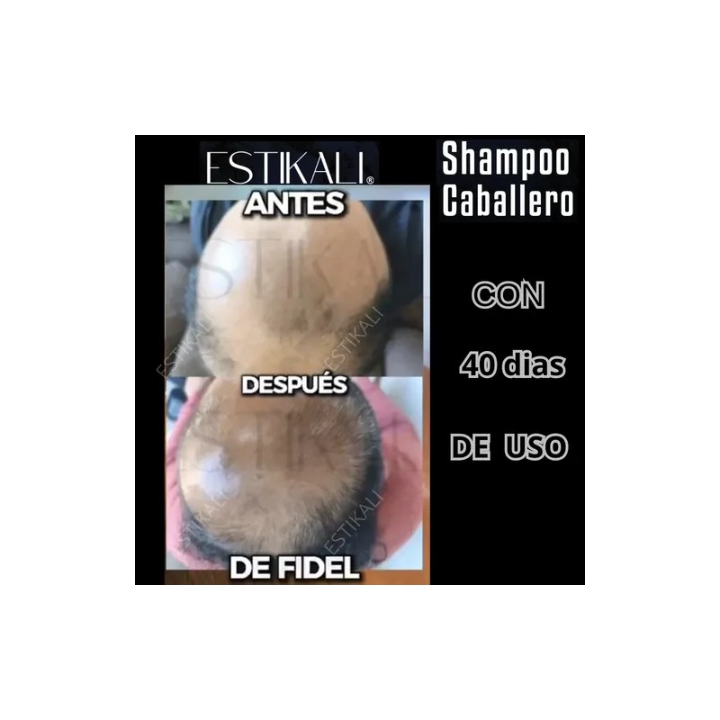 Shampoo Anticaída Anticaspa Antigraso Crecimiento De Cabello