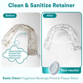 Weiss Naturals Retainer Cleaner Tablets, Invisalign Cleaner, Remove Stains, Odors & Plaque, PERSULFATE FREE Night Guard & Denture Cleaner 4-Month Supply, 120 Mint Scented Tablets
