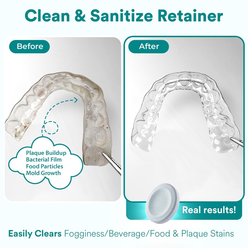 Weiss Naturals Retainer Cleaner Tablets, Invisalign Cleaner, Remove Stains, Odors
