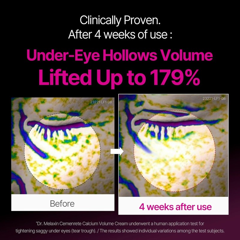 Cemenrete Calcium Intense Cream – Anti-Aging, Elasticity & Volume Boost