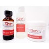85% Lactic Acid Peel Kit ~ Reduces Fine Lines, Age