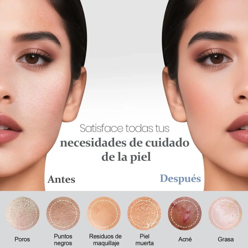 Limpiador Facial Limpieza Eléctrico Ultrasónica Scrubber