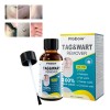 Líquido Para Verrugas 30 Ml - Eliminación Rápida
