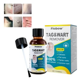 Líquido Para Verrugas 30 Ml - Eliminación Rápida