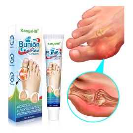 A Pomada Para El Dolor Del Juanete B Pomada Para El