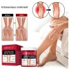 Varicose Veins Relief