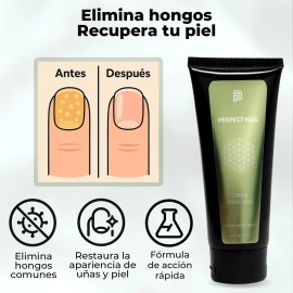 Beauty Freedom Crema Uñas Quebradizas Antifúngico 100gr