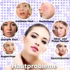 Ice Roller Facial Ice Roller Face Roller Face Massager Improvement