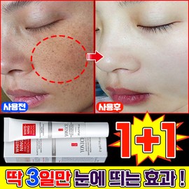 {Domestic Shipping | 100% Effective} 1/1+1/2+2 Freckle Cream, Cream for Melasma and Dark Spots, Freckle Removal Cream, Hyperpigmentation Whitening Cream, Perilla Freckle Cream, Whitening LUPEIYA, 20.01g, 2 pieces