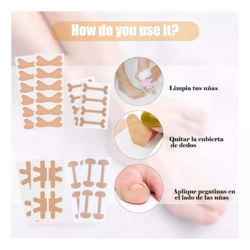 Dolores Kit Pedicure Corrector Uña Tratamient Enterradas Herramienta