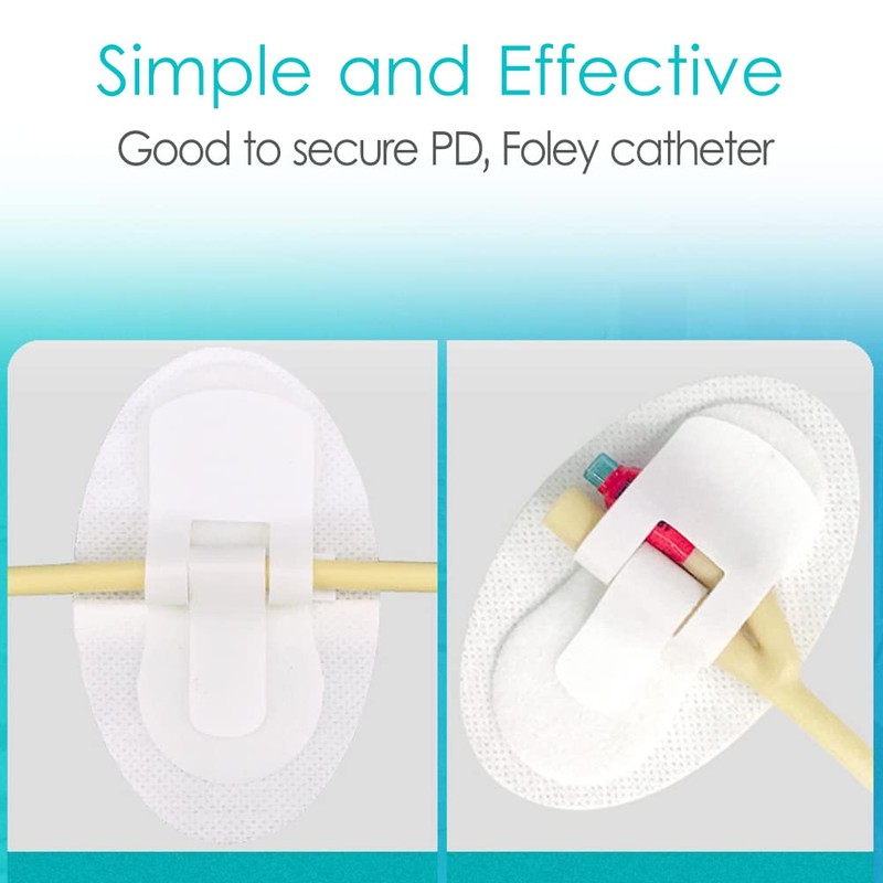Peritoneal Dialysis PD Catheter Holder Adhesive Patch Stabilization Device for