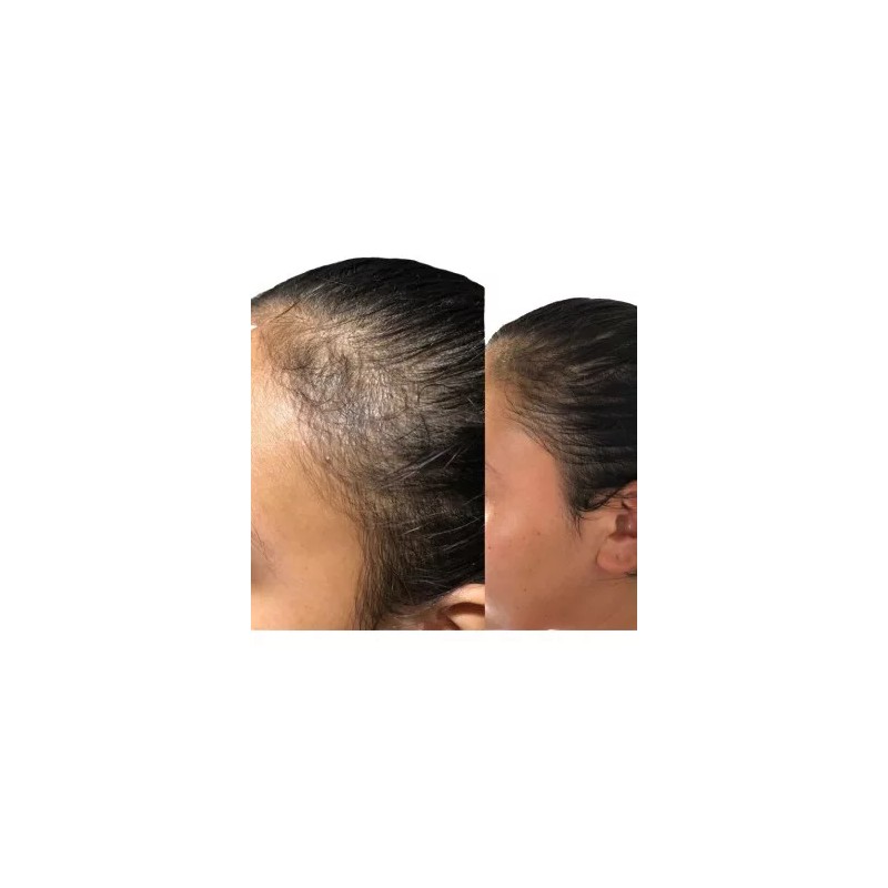 Nutrekcln Crema Acondicionadora Con Nutrientes Para Mejora De Vello