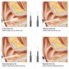 Digital Otoscope Camera Ultra Clear View 6 LED Lights IP67