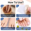 Nail Patches - Toenail Care for Toenail Fingernails - 8-Hour