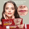 KOAHDE Lip Herpes Repair Cream, Herpes Cream for Lip Sores,