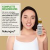 NAKUNGOO Hair Growth Oil Ätherisches Rosmarinöl, um Haarwachstum zu Beschleunigen,