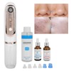 Small Bubble Blackhead Cleaner Kit Toner Blackhead Export Liquid Pore