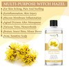 Supremely Witch Hazel Liquid|Pure & Natural Cruelty Free Cleansing &