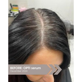 SEVEN SATARA OPTI Shampoo for Women & Men, Hair Growth & Thinning Solutions with Procapil + Capixyl, Promotes Fuller, Healthier Locks, Plant-Based Hair Shampoo for Vitality & Restoration, 7 fl oz