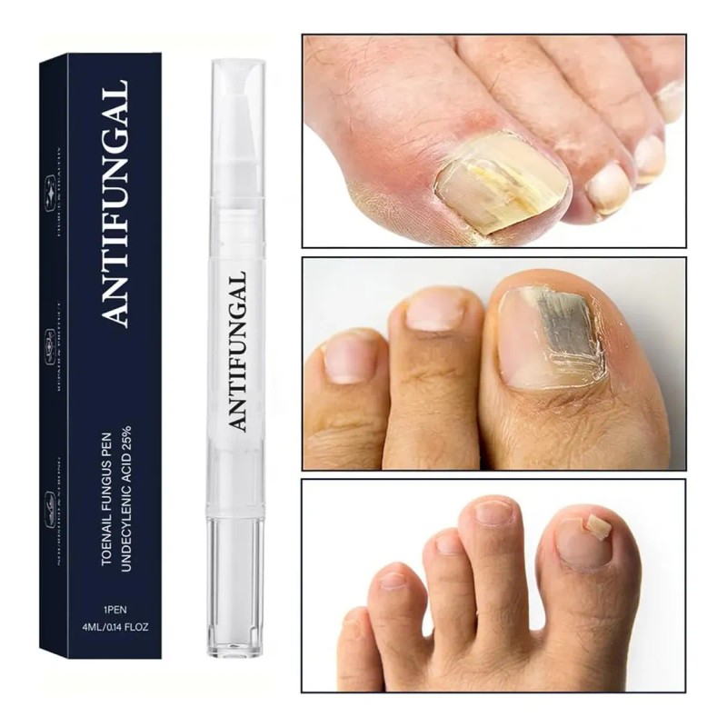 Seralia Lápiz Antihongos 3 Unids, Cuidado Cosmético Uñas /
